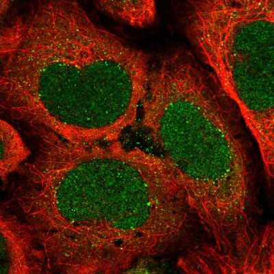 Immunocytochemistry/Immunofluorescence: ATP6V1A Antibody [NBP2-55164] - Staining of human cell line U-2 OS shows localization to nucleus, cytosol & vesicles.