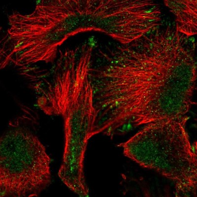 Immunocytochemistry/Immunofluorescence: PWWP2A Antibody [NBP2-55423] - Staining of human cell line U-251 MG shows localization to nucleoplasm & focal adhesion sites.