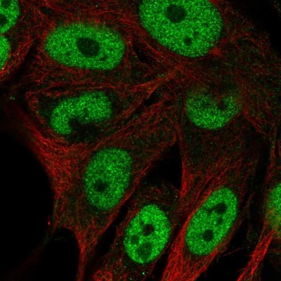 Immunocytochemistry/Immunofluorescence: GAL3ST4 Antibody [NBP2-55274] - Staining of human cell line SK-MEL-30 shows localization to nucleoplasm.