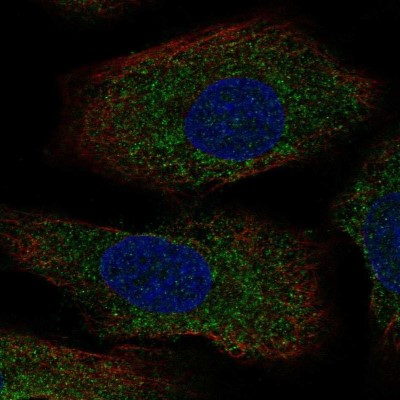 Immunocytochemistry/Immunofluorescence: Serotonin N-acetyltransferase Antibody [NBP2-55364] - Staining of human cell line A549 shows localization to cytosol.