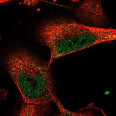 Immunocytochemistry/Immunofluorescence: FANCI Antibody [NBP2-55040] - Staining of human cell line U-251 MG shows localization to nucleoplasm & cytosol.