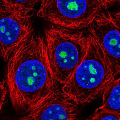 Immunocytochemistry/Immunofluorescence: LLPH Antibody [NBP2-54933] - Staining of human cell line MCF7 shows localization to nucleoli.