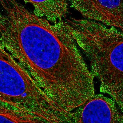 Immunocytochemistry/Immunofluorescence: Rasgrp1 Antibody [NBP2-55057] - Staining of human cell line U-2 OS shows localization to plasma membrane & cytosol.
