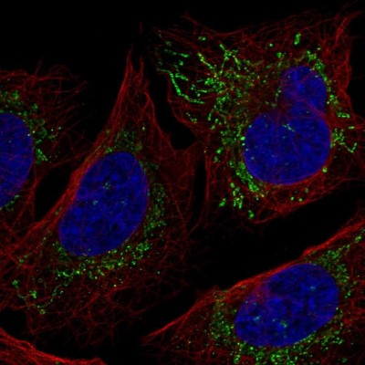 Immunocytochemistry/Immunofluorescence: SHPRH Antibody [NBP2-55114] - Staining of human cell line U-2 OS shows localization to mitochondria.