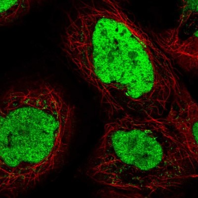 Immunocytochemistry/Immunofluorescence: TEX2 Antibody [NBP2-55394] - Staining of human cell line A-431 shows localization to nucleus.