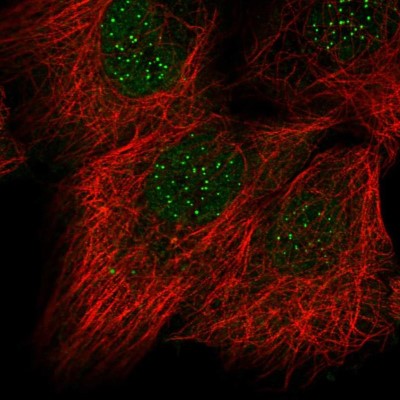 Immunocytochemistry/Immunofluorescence: CENPC Antibody [NBP2-55474] - Staining of human cell line A-431 shows localization to nucleoplasm & nuclear bodies.