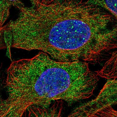 Immunocytochemistry/Immunofluorescence: DCP1B Antibody [NBP2-55470] - Staining of human cell line U-2 OS shows localization to cytosol.