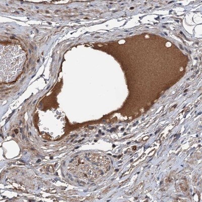 Immunohistochemistry: C14orf80 Antibody [NBP2-38439] - Staining of human soft tissue shows positivity in plasma.