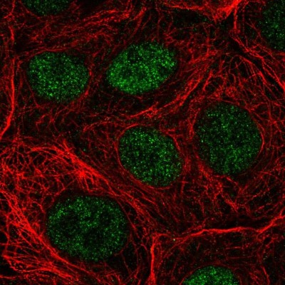 Immunocytochemistry/Immunofluorescence: NUDT22 Antibody [NBP2-55381] - Staining of human cell line MCF7 shows localization to nucleoplasm.