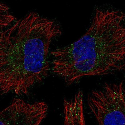 Immunocytochemistry/Immunofluorescence: CENTB1 Antibody [NBP2-55692] - Staining of human cell line HeLa shows localization to vesicles.