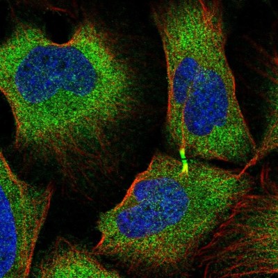 Immunocytochemistry/Immunofluorescence: TRIM45 Antibody [NBP2-55311] - Staining of human cell line U-2 OS shows localization to cytosol & cytokinetic bridge.