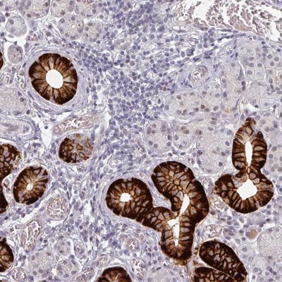 Immunohistochemistry-Paraffin: Sodium Iodide Symporter Antibody [NBP2-33547] - Staining of human salivary gland shows membranous positivity in ductal cells.
