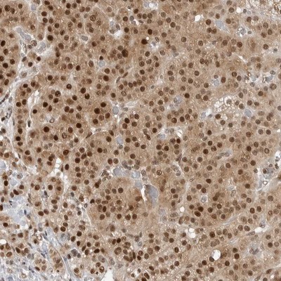 Immunohistochemistry-Paraffin: C8orf33 Antibody [NBP1-82155] - Staining of human adrenal gland shows distinct nuclear and cytoplasmic positivity in cortical cells.