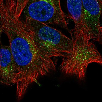 Immunocytochemistry/Immunofluorescence: ABHD6 Antibody [NBP2-57800] - Staining of human cell line SK-MEL-30 shows localization to vesicles.