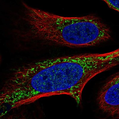 Immunocytochemistry/Immunofluorescence: FASTKD2 Antibody [NBP2-57917] - Staining of human cell line U-2 OS shows localization to mitochondria & cytokinetic bridge.