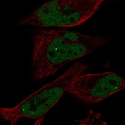 Immunocytochemistry/Immunofluorescence: EYA1 Antibody [NBP2-58069] - Staining of human cell line RH-30 shows localization to nucleoplasm & nuclear bodies.