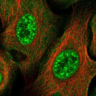 Immunocytochemistry/Immunofluorescence: ZNF337 Antibody [NBP2-58201] - Staining of human cell line U-2 OS shows localization to nuclear speckles & plasma membrane.