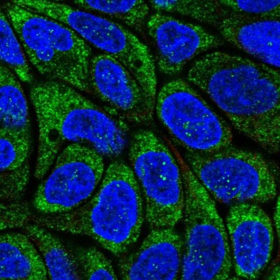 Immunocytochemistry/Immunofluorescence: Viperin Antibody [NBP2-58186] - Staining of human cell line RT4 shows localization to nucleoli fibrillar center & endoplasmic reticulum.