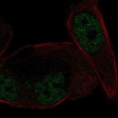 Immunocytochemistry/Immunofluorescence: Mineralocorticoid R/NR3C2 Antibody [NBP2-57853] - Staining of human cell line PC-3 shows localization to nucleoplasm.