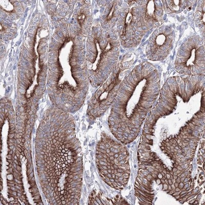 Immunohistochemistry: C6orf1 Antibody [NBP2-48676] - Staining of human stomach, lower shows strong cytoplasmic and membranous positivity in glandular cells.