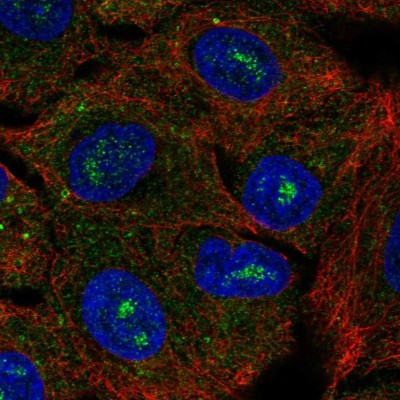 Immunocytochemistry/Immunofluorescence: CACNG6 Antibody [NBP2-56816] - Staining of human cell line A549 shows localization to nucleoli fibrillar center & cytosol.
