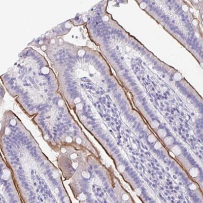 Immunohistochemistry-Paraffin: C7orf63 Antibody [NBP2-32373] - Staining of human small intestine shows moderate membranous positivity in glandular cells.