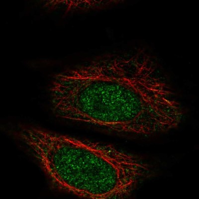 Immunocytochemistry/Immunofluorescence: ZYG11A Antibody [NBP2-57550] - Staining of human cell line SiHa shows localization to nucleus.