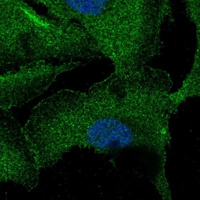 Immunocytochemistry/Immunofluorescence: ZNF785 Antibody [NBP2-57609] - Staining of human cell line U-2 OS shows localization to plasma membrane.