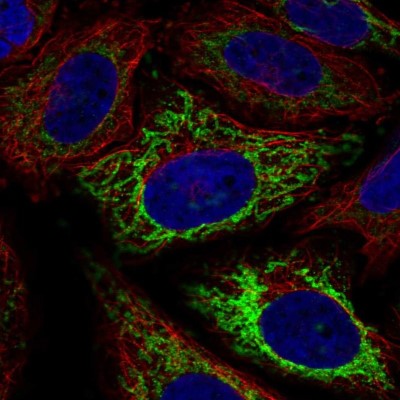 Immunocytochemistry/Immunofluorescence: MFF Antibody [NBP2-57687] - Staining of human cell line SiHa shows localization to mitochondria.