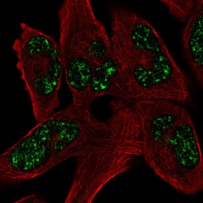 Immunocytochemistry/Immunofluorescence: SOHLH1 Antibody [NBP2-56883] - Staining of human cell line RH-30 shows localization to nuclear speckles.
