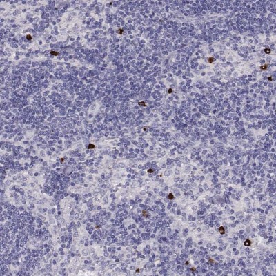 Immunocytochemistry/Immunofluorescence: P2Y10/P2RY10 Antibody [NBP2-56283] - Immunohistochemical staining of human lymph node shows strong cytoplasmic positivity in non-germinal center cells.