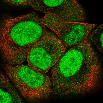 Immunocytochemistry/Immunofluorescence: PMS2 Antibody [NBP2-56323] - Staining of human cell line HaCaT shows localization to nucleoplasm & cytoplasmic bodies.