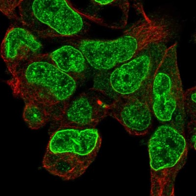 Immunocytochemistry/Immunofluorescence: CPD Antibody [NBP2-56159] - Staining of human cell line HEK 293 shows localization to nuclear speckles & nuclear membrane.