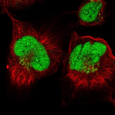 Immunocytochemistry/Immunofluorescence: ANKRD49 Antibody [NBP2-56336] - Staining of human cell line U-251 MG shows localization to nucleus, nucleoli fibrillar center & the Golgi apparatus.