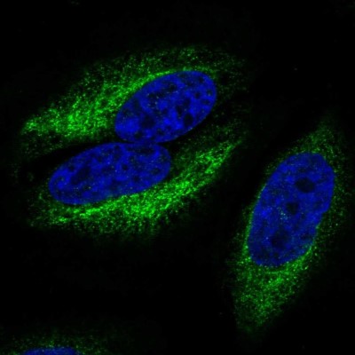 Immunocytochemistry/Immunofluorescence: CCR10/GPR2 Antibody [NBP2-56272] - Staining of human cell line HeLa shows localization to endoplasmic reticulum.