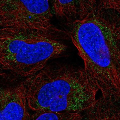 Immunocytochemistry/Immunofluorescence: ARHGAP20 Antibody [NBP2-56355] - Staining of human cell line U-2 OS shows localization to mitochondria.