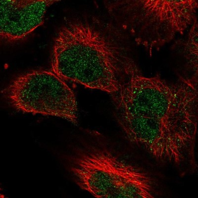Immunocytochemistry/Immunofluorescence: Lysine (K)-specific Demethylase 3A/KDM3A/JMJD1A Antibody [NBP2-56254] - Staining of human cell line U-251 MG shows localization to nucleoplasm.
