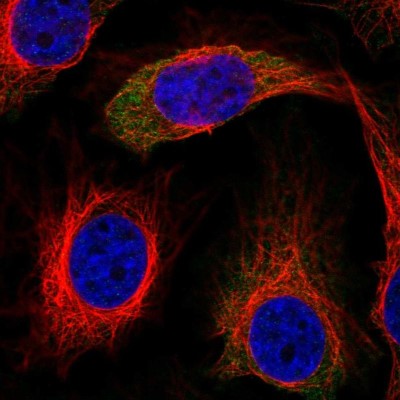 Immunocytochemistry/Immunofluorescence: IRS2 Antibody [NBP2-56211] - Staining of human cell line HeLa shows localization to cytosol.