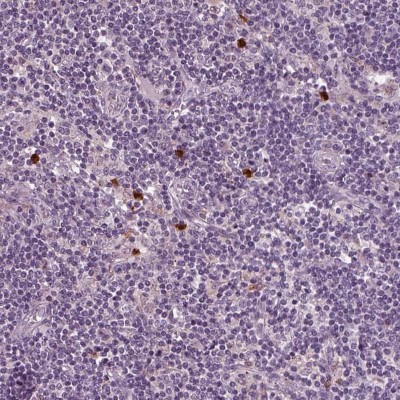 Immunocytochemistry/Immunofluorescence: BLAME/SLAMF8 Antibody [NBP2-56595] - Immunohistochemical staining of human lymph node shows strong cytoplasmic and nuclear positivity in a small subset of non-germinal center cells.