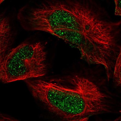 Immunocytochemistry/Immunofluorescence: ARID2 Antibody [NBP2-57220] - Staining of human cell line U-2 OS shows localization to nucleoplasm.