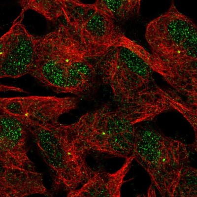 Immunocytochemistry/Immunofluorescence: ACTR8 Antibody [NBP2-57111] - Staining of human cell line SH-SY5Y shows localization to nucleus & centrosome.