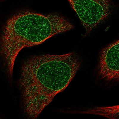 Immunocytochemistry/Immunofluorescence: SIX2 Antibody [NBP2-54917] - Staining of human cell line U-2 OS shows localization to nuclear membrane.