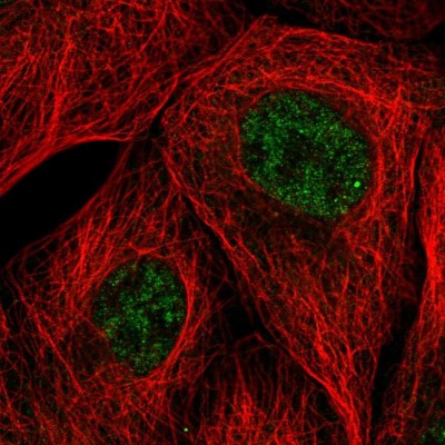 Immunocytochemistry/Immunofluorescence: EMC7 Antibody [NBP2-57188] - Staining of human cell line A-431 shows localization to nucleoplasm.