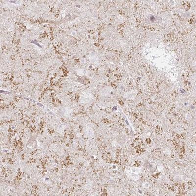 Immunohistochemistry-Paraffin: Glutamate Receptor 3 Antibody [NBP2-37972] - Staining of human hippocampus shows positivity in neuropil.