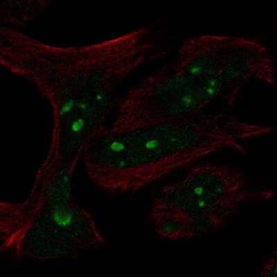 Immunocytochemistry/Immunofluorescence: n-Myc Antibody [NBP2-56178] - Staining of human cell line RH-30 shows localization to nucleoli.