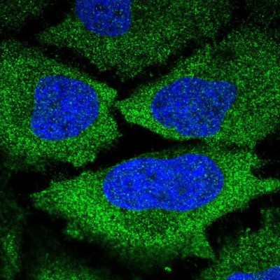 Immunocytochemistry/Immunofluorescence: KLHL9 Antibody [NBP2-56152] - Staining of human cell line HeLa shows localization to cytosol.