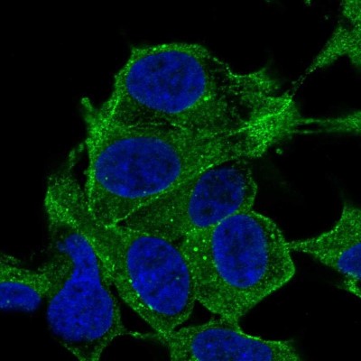 Immunocytochemistry/Immunofluorescence: SYNPO2 Antibody [NBP2-56174] - Staining of human cell line SH-SY5Y shows localization to cytosol, actin filaments & vesicles.