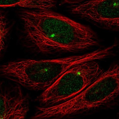Immunocytochemistry/Immunofluorescence: ZMYM1 Antibody [NBP2-55906] - Staining of human cell line SiHa shows localization to microtubule organizing center.