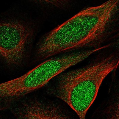 Immunocytochemistry/Immunofluorescence: CCDC3 Antibody [NBP2-56013] - Staining of human cell line U-2 OS shows localization to nucleus & cytosol.