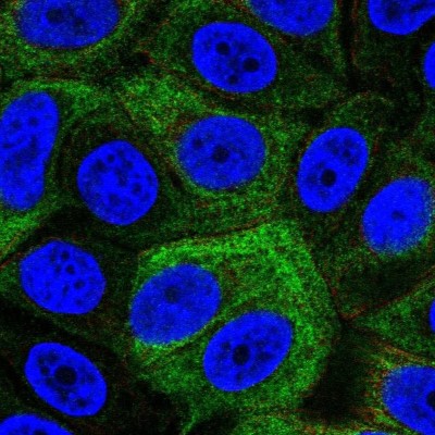 Immunocytochemistry/Immunofluorescence: SRMS Antibody [NBP2-55947] - Staining of human cell line MCF7 shows localization to cytosol & intermediate filaments.
